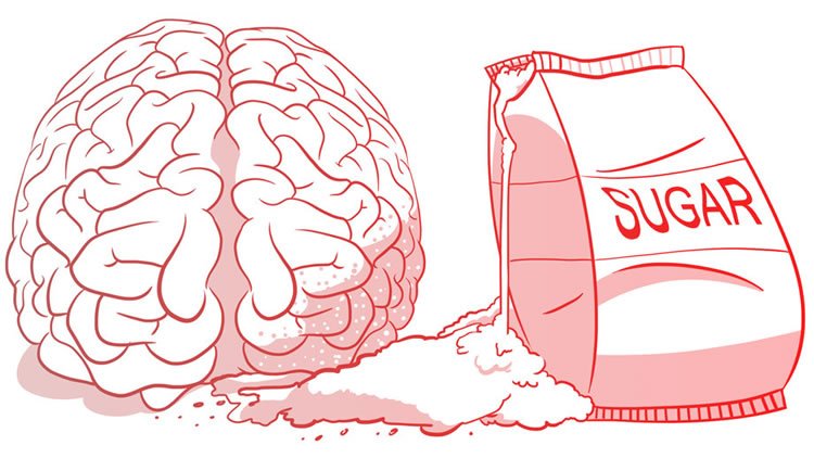 Is dementia type 3 diabetes? - And sketch of a brain next to a bag of sugar